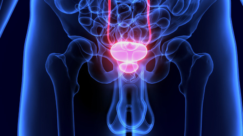 26-20--20hiperplasia-20benigna-20de-20la-20prostata-20(hbp)